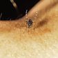 The female Anopheles mosquito transmit malaria [iStock]