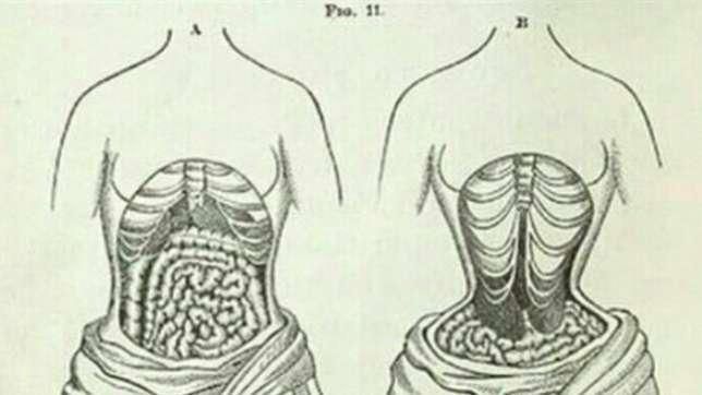 Corsets compress your waist, pushing your internal organs upwards [Nairaland]