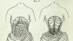 Corsets compress your waist, pushing your internal organs upwards [Nairaland]