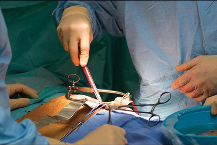 Kidney transplant [Dr. Vikas Agarwal]