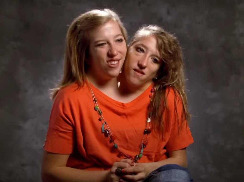 Abby and Brittany Hensel on their TLC show.TLC