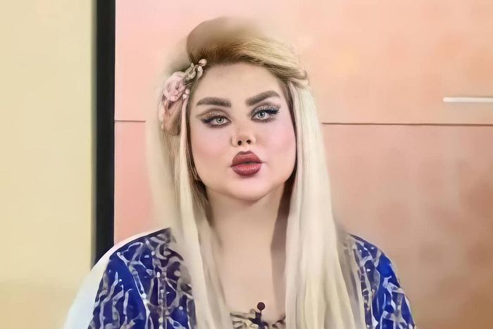 Dalia Naeem underwent 43 surgeries to look like Barbie [Instagram]