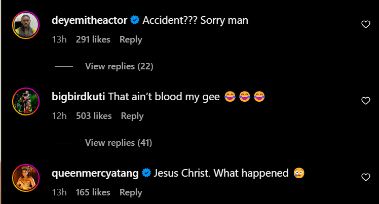 Reactions to Skales' post [Instagram/Skales]