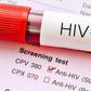 Very few people in Ghana have taken HIV tests