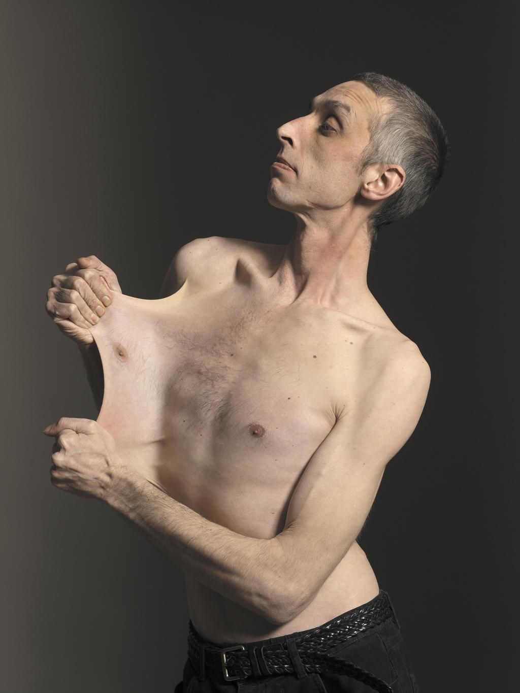 Man with the stretchiest skin Garry Turner