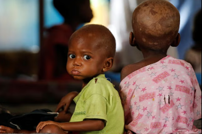 Malnourished children [The Independent]