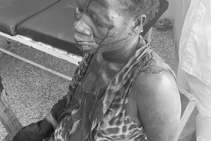 Pregnant woman battles for life after being butchered by husband in Nchumuru