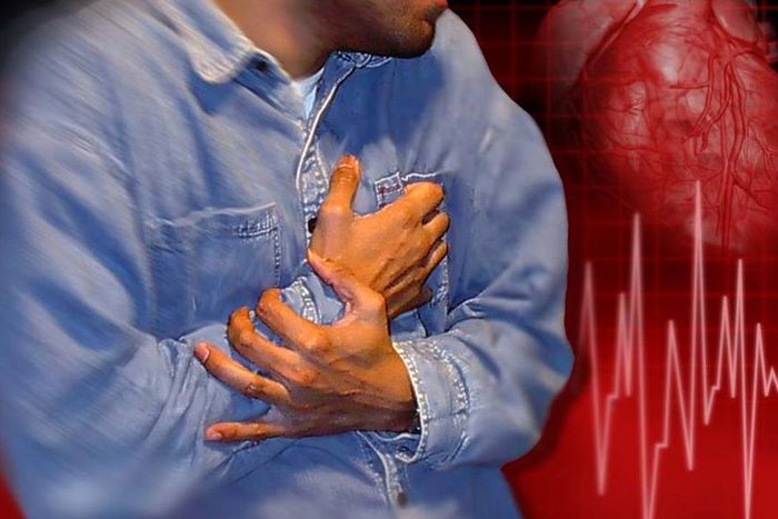 Why men are more prone to cardiovascular disease? [MiamiHerald]