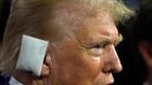 Former President Donald Trump sporting a huge bandage on the first day of the Republican National Convention in Milwaukee.Evan Vucci/AP