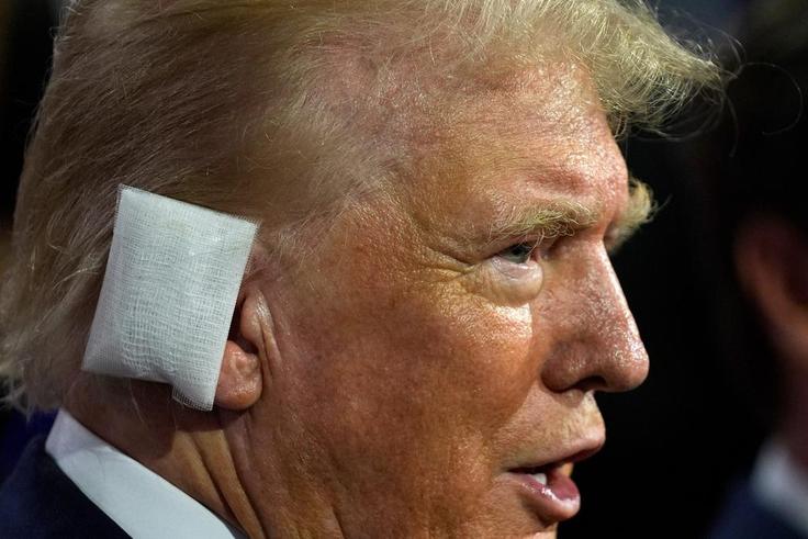 Former President Donald Trump sporting a huge bandage on the first day of the Republican National Convention in Milwaukee.Evan Vucci/AP