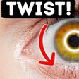 Did you know the eyes could twist [BrightSide]