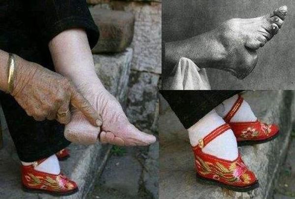 Foot binding in China [EverydayEasyChina]