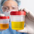 What's normal or not about your urine colour [MetropolisHealthcare]