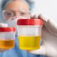 What's normal or not about your urine colour [MetropolisHealthcare]
