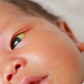 Babies with jaundice [NHS]