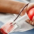 What your blood type can tell you about your health [HellaLife]