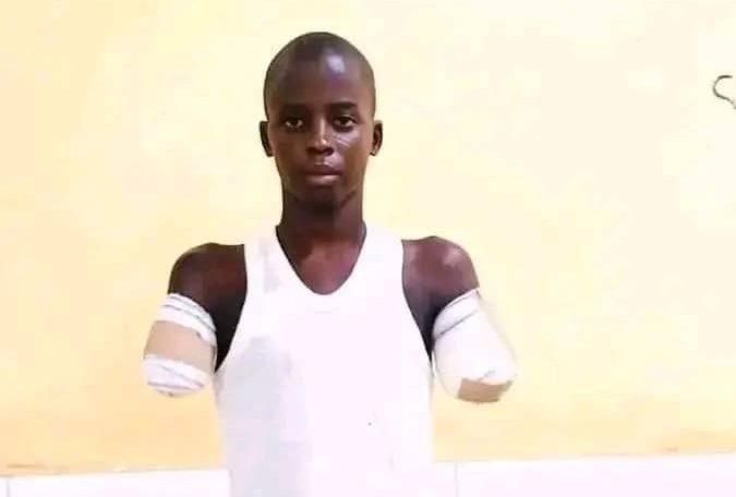 Uncle cuts 12-year-old boy's arms over alleged phone theft, NBA seeks ...