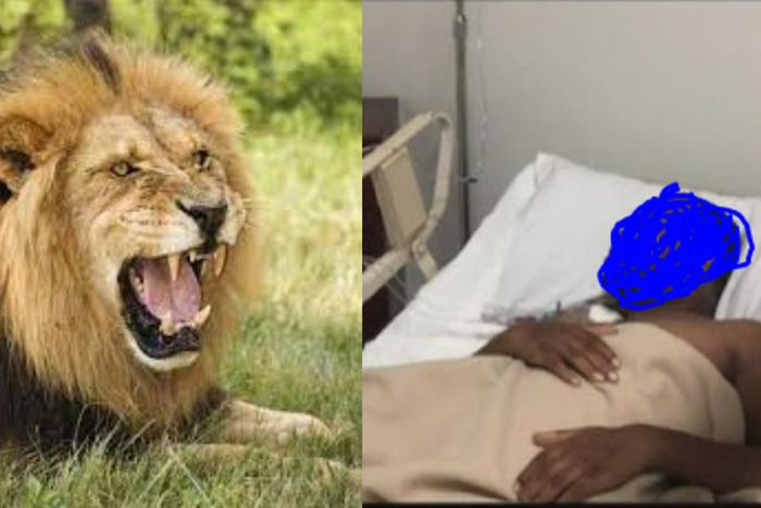 Brave husband and wife hospitalised after defeating wild lion in an attack