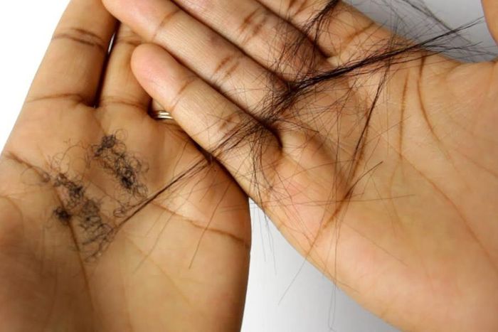 Brittle hair may be a sign of nutrient deficiency [Youtube]