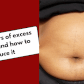 The dangers of excess belly fat