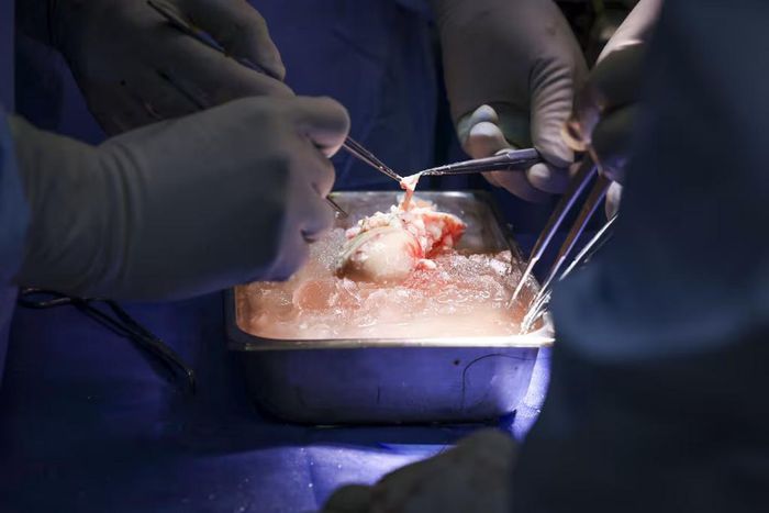 The pig kidney transplanted into Richard Slayman [MGH]