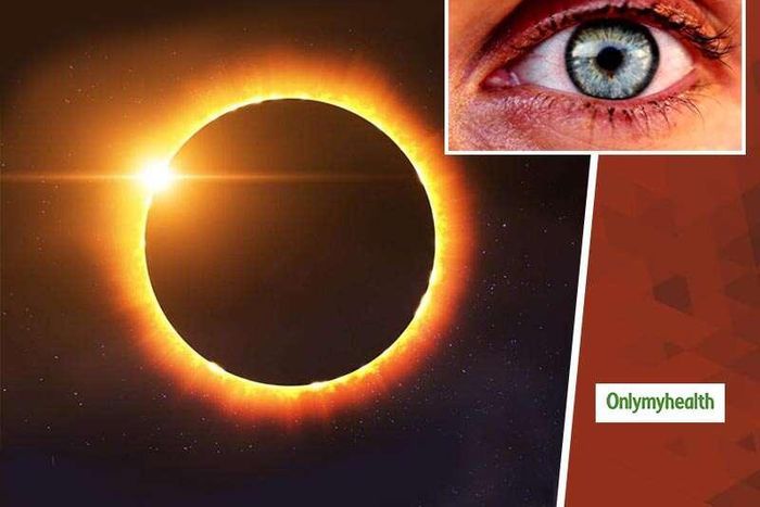 Solar eclipse can hurt your eyes [OnlyMyHealth]