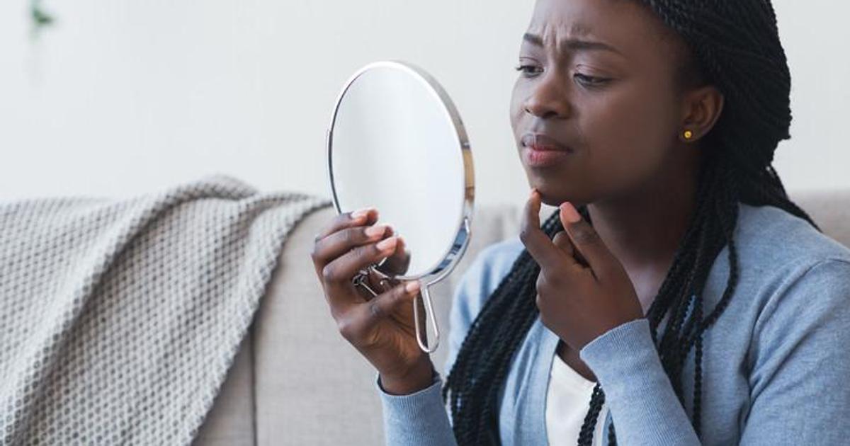 5 common skin problems and how to avoid them | Pulse Nigeria