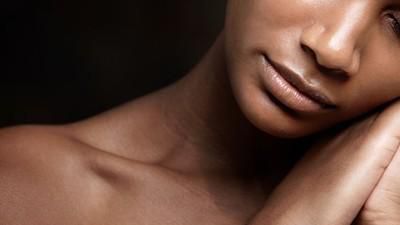 Your skin help regulate body temperature [SindicatodosBancá]