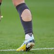 Why do so many footballers cut holes in their socks? [huffpost]
