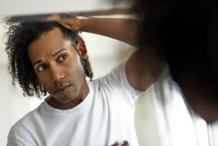 For Men: Find out if your hairline is receding before it's too late
