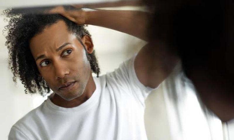For Men: Find out if your hairline is receding before it's too late