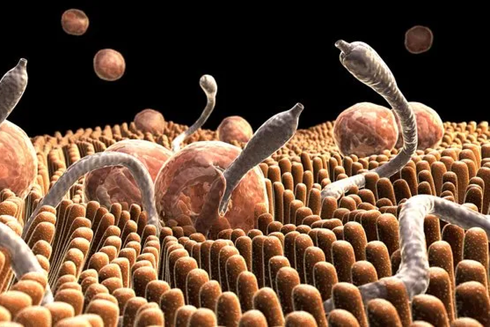 Why you need to deworm intestinal worms [Australiageographic]