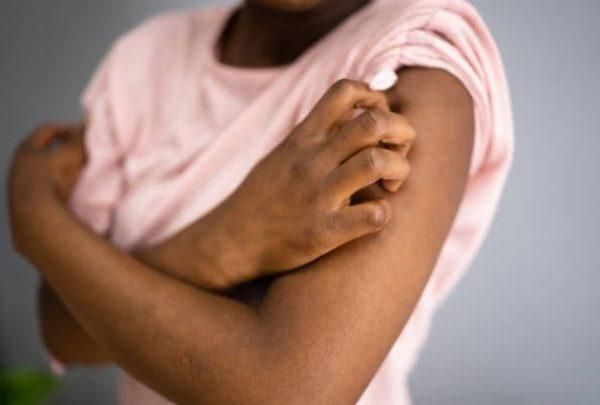 Regular bathing helps prevent these issues [FakazaNews]