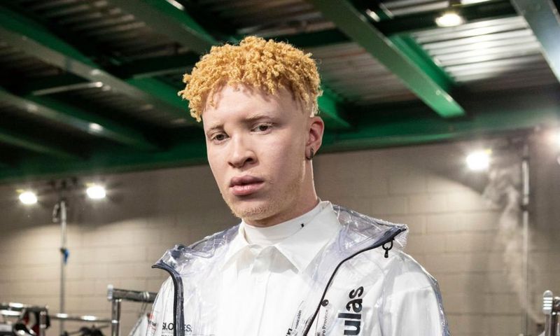 7 common myths about people living with Albinism [Getty Images]