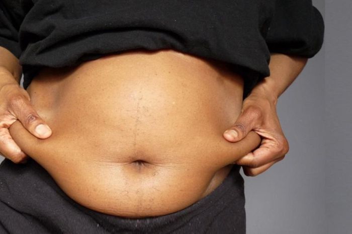 Vegetables that burn belly fat [Shuttershock]