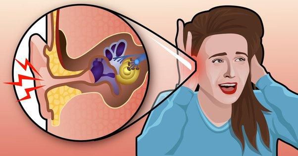 Exposure to loud noises can cause tinnitus [Quora]