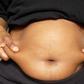 Belly fat