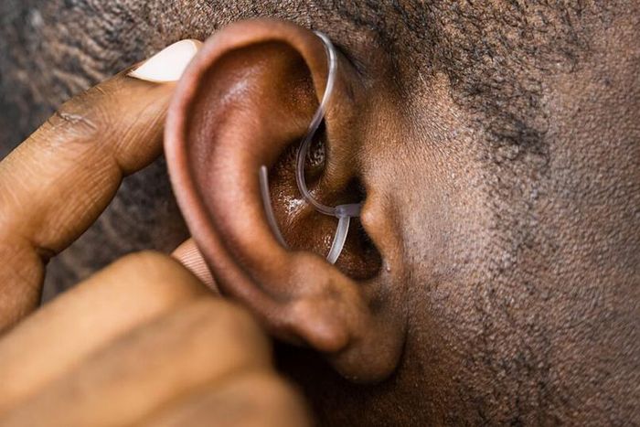 Hearing aid [UF Health]