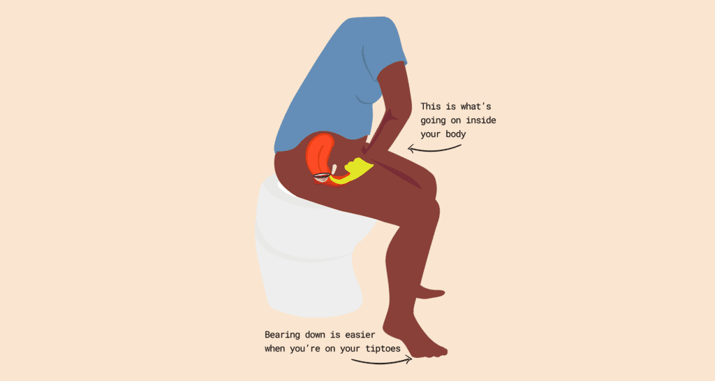 How to remove a stuck tampon [TheFornixblog]