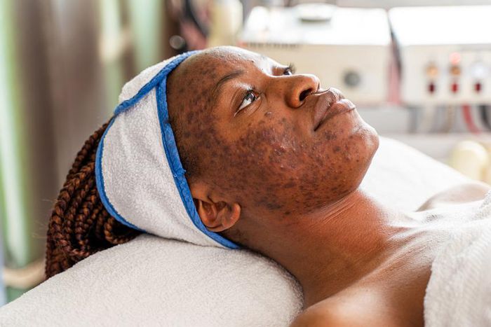 Why your skin is getting darker [goodrx]