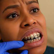 Lose 15kg In 6 Weeks: The shocking reality of jaw wiring