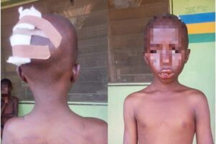 Man flees after beating, injuring his 2 children in Lagos