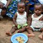 Malnutrition in Children