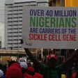 80 Sickle Cell patients died due to blood shortage in Kano. [Daily post]