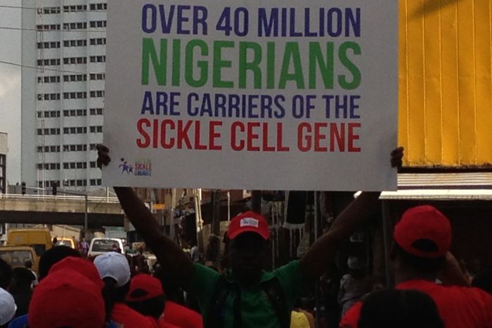 80 Sickle Cell patients died due to blood shortage in Kano. [Daily post]