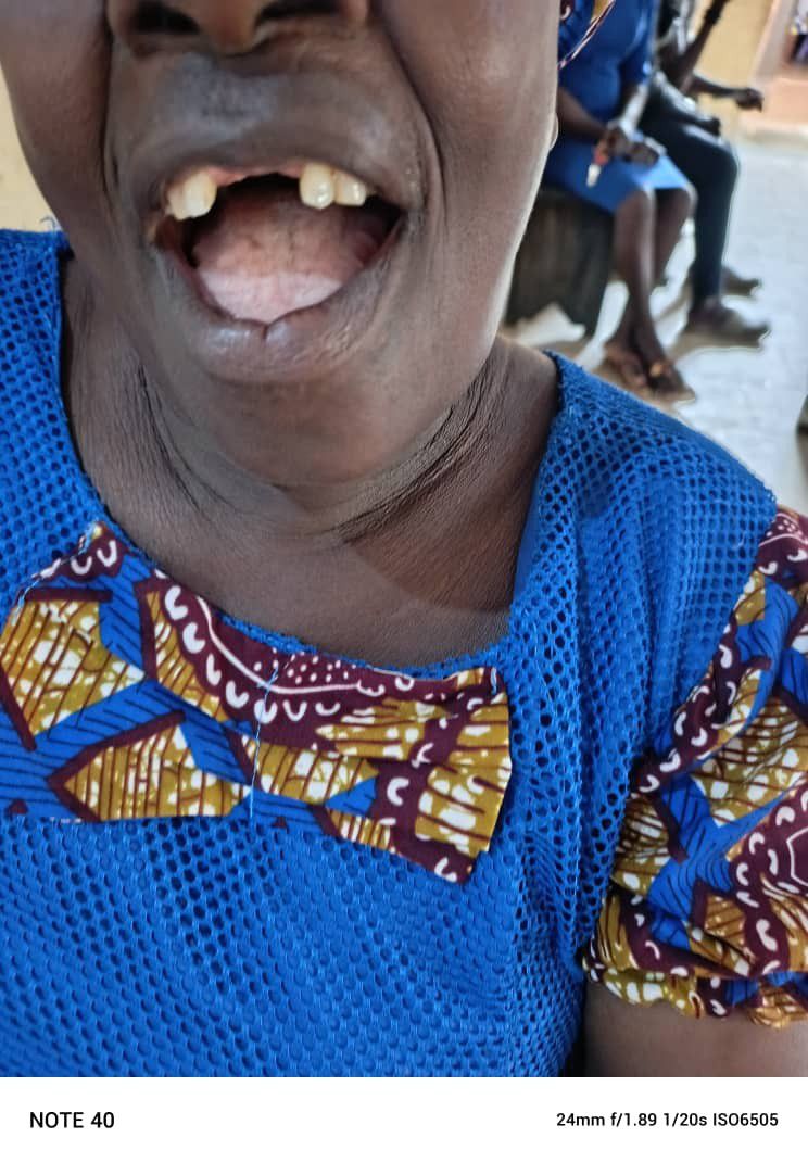 Pepsodent launches ‘Talk to a Dentist' campaign in Osun, Ondo States