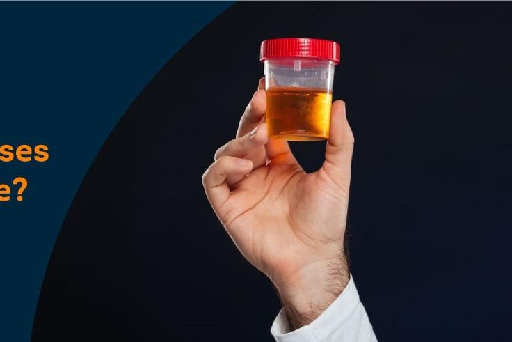 Why your urine looks darker in the morning [PristynCare]