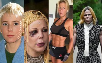 How a childhood accident led to a physical transformation for Princess Kalina of Bulgaria.