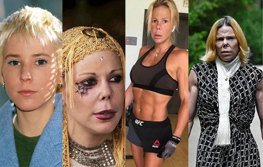 How a childhood accident led to a physical transformation for Princess Kalina of Bulgaria.