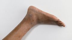 How to prevent white, cracked feet during harmattan [babymigo]